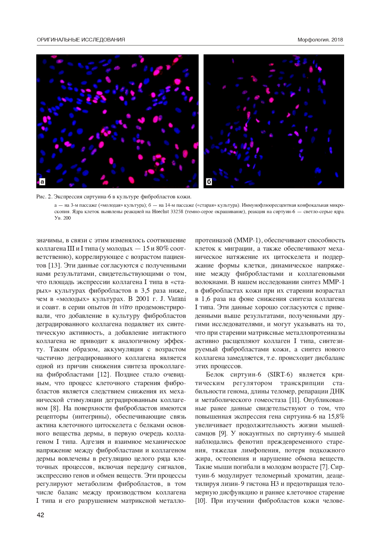 Экспрессия коллагена I типа, сиртуина-6 и матриксной металлопротеиназы-1 в фибропластах кожи человека в процессе длительного культивирования